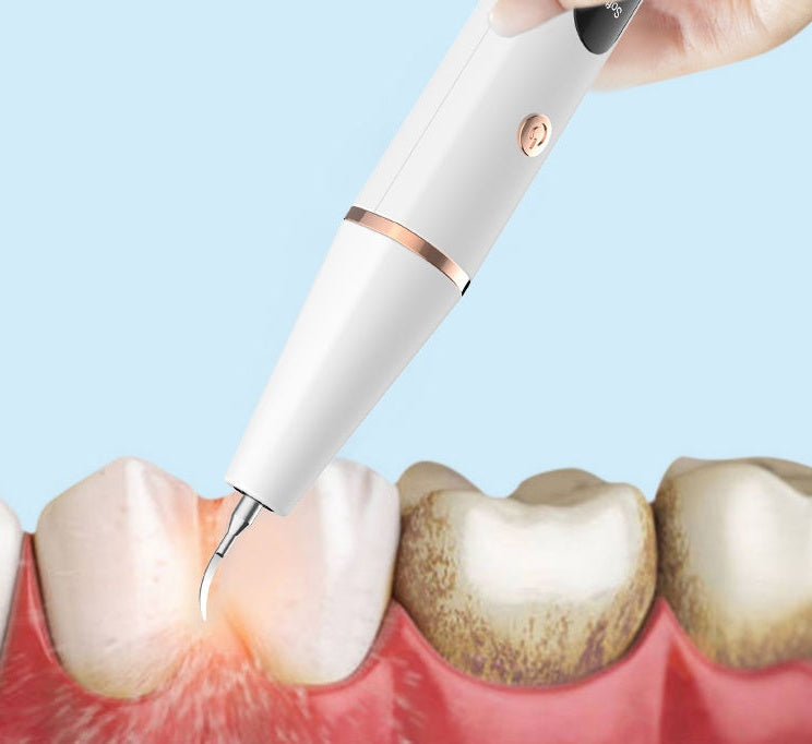 New Ultrasonic Household Dental Calculus Removal Instant Electric Dental Scaler