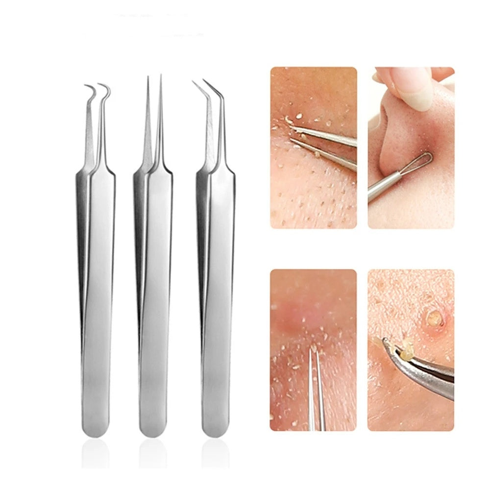 Led Acne Needle Tweezers Needle Nose Pointed Tips Eyebrows Tweezers For Splinters Blackhead Removal Acne Clip Extractor