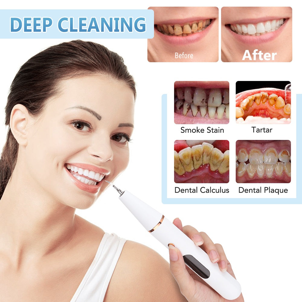 New Ultrasonic Household Dental Calculus Removal Instant Electric Dental Scaler
