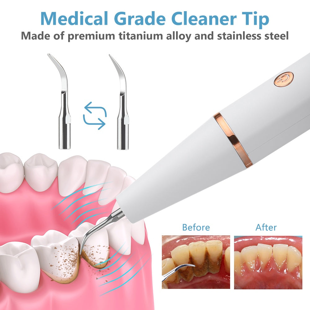 New Ultrasonic Household Dental Calculus Removal Instant Electric Dental Scaler